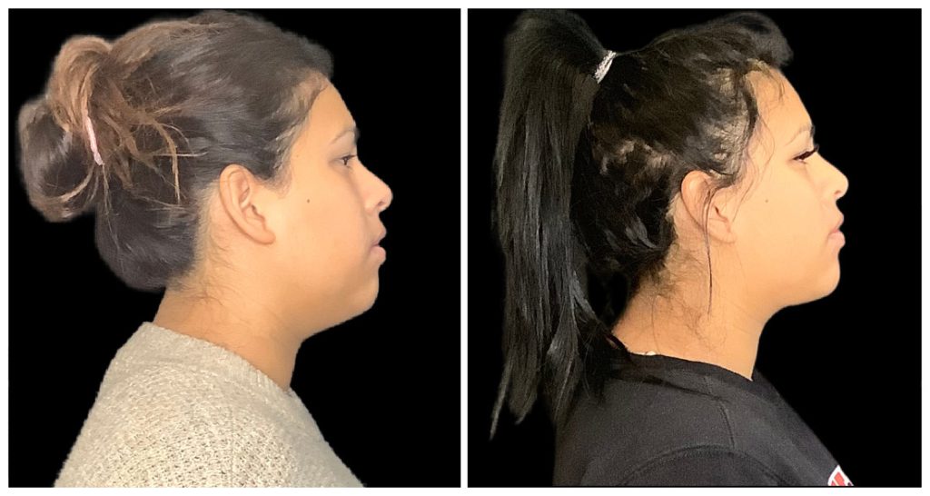 Profile view of a person with hair styled in a bun on the left and in a ponytail on the right, showcasing different hairstyles.